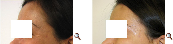 Before/After